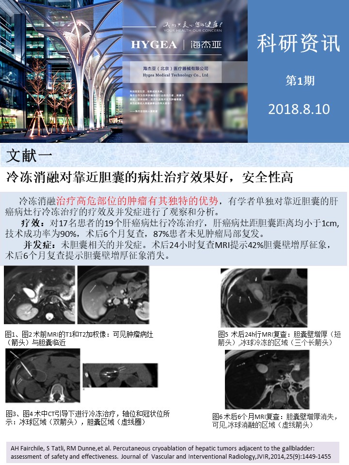 【海杰亞科研資訊】第1期——肝、肺癌消融